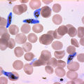 Plasmodium falciparum