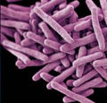 Mycobacterium tuberculosis